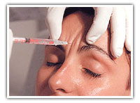 Inyectando Botox Arrugas